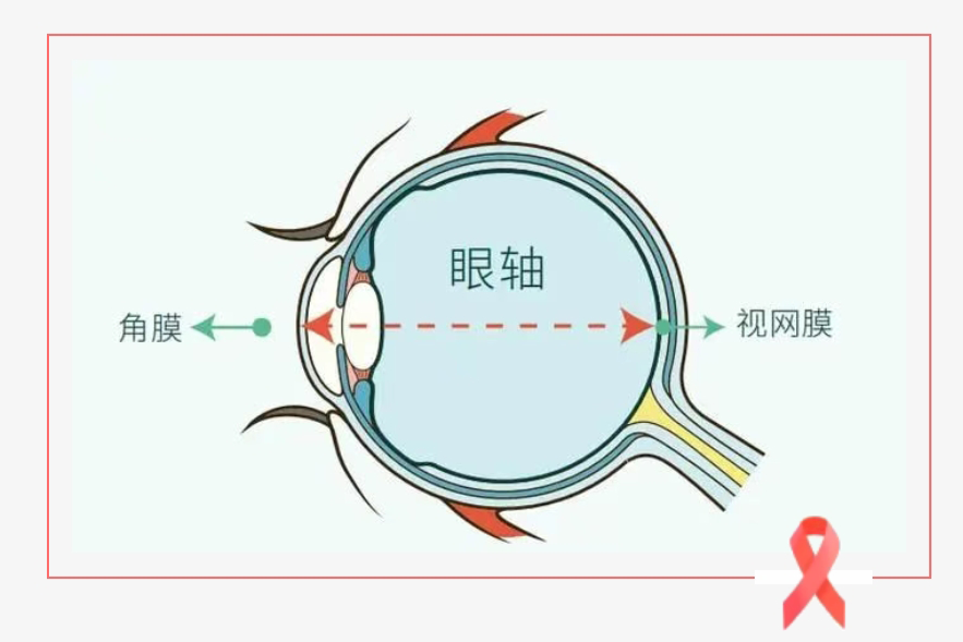 在关注孩子眼睛的视力和度数之外，这个“金标准"也很重要!